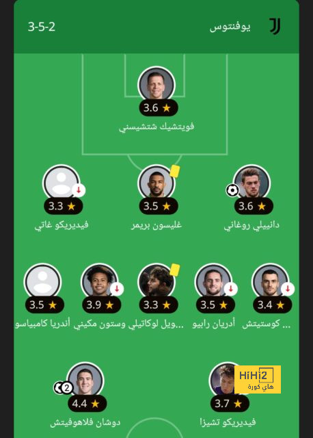 تعرف على طبيعة اصابة ديمبيلي و فترة غيابه عن الملاعب ! 